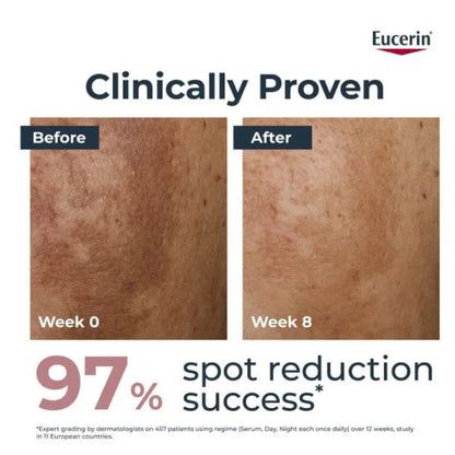 Eucerin Anti-Pigment Hyperpigmentation Anti-Pigment Dual Serum